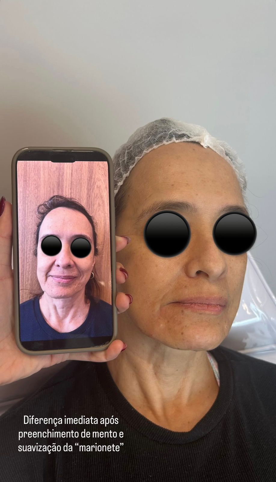 Imagem ilustrativa de resultados